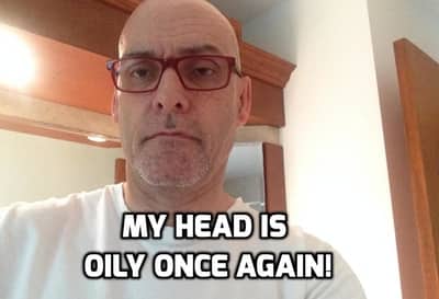 Small bald head